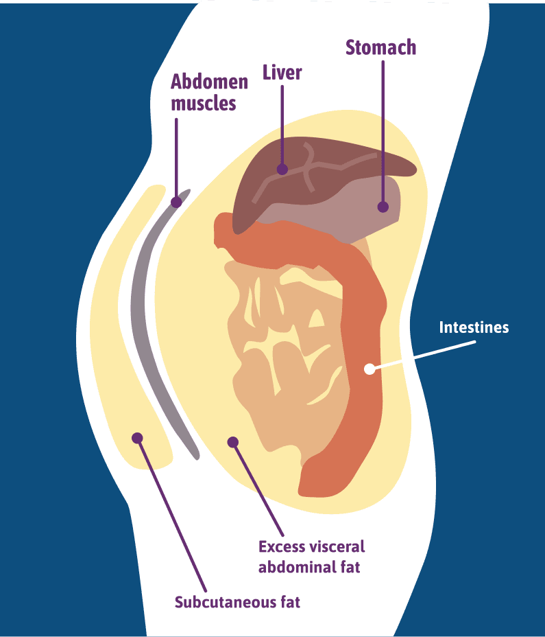 Diagram of abdominal fat